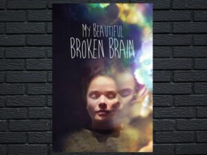 -My Beautiful Broken Brain (2014)-<br>The Original Movie