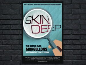 -Skin Deep: The Battle Over Morgellons (2019)-<br>The Original Movie